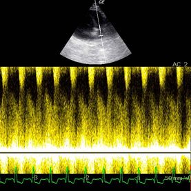 Clínica Veterinaria Romareda doppler espectral, flujo continuo CAP